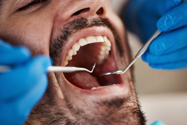 Best Dentist for Tooth Abscess  in Tlassee, AL